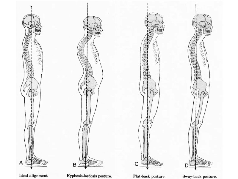 4 type of posture